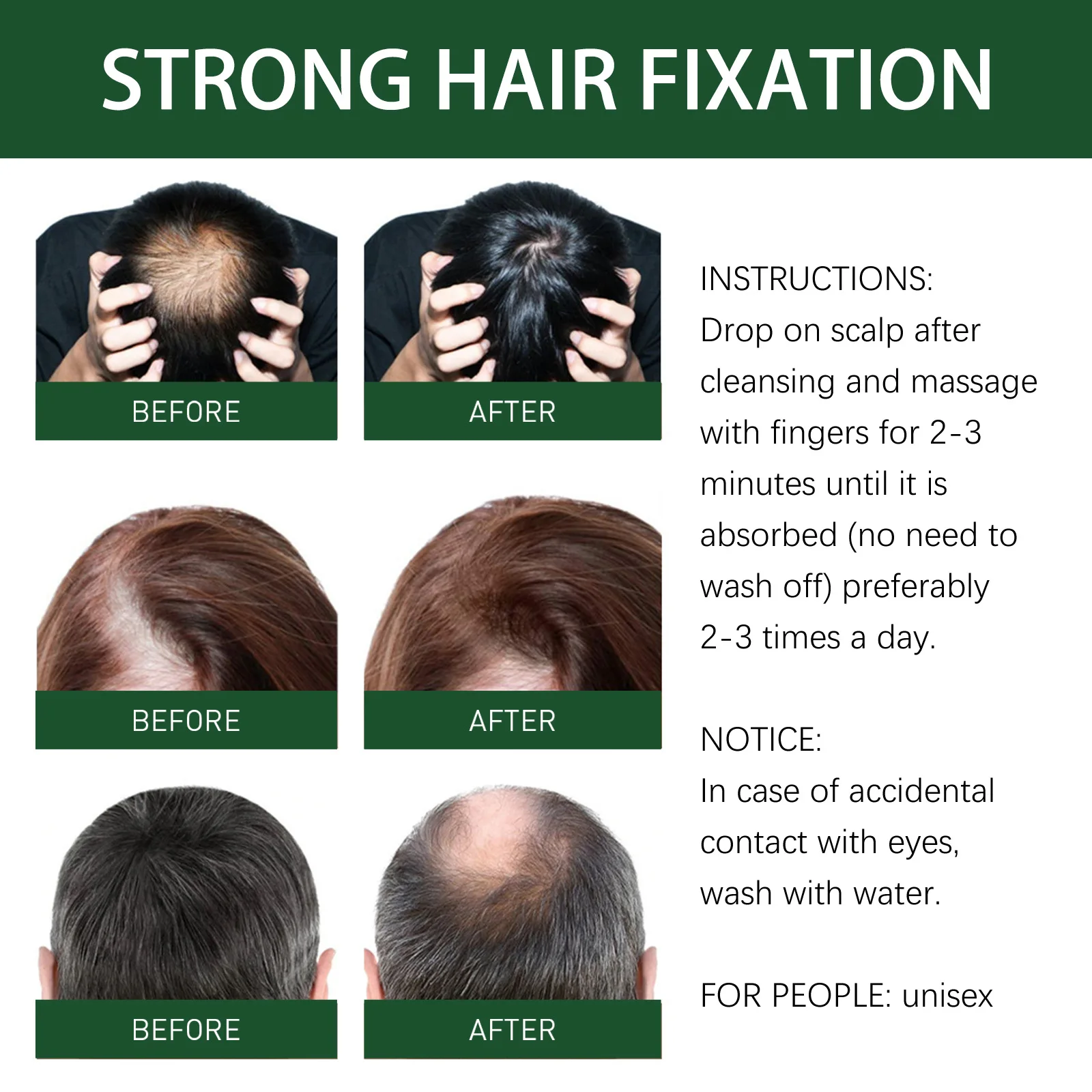 Anti-Hair Loss Óleos Essenciai - Licorice Root Sticks avaliação e preço