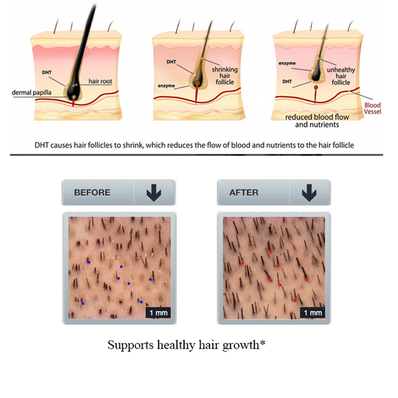 Purc 100ml gengibre perda de c - Licorice Root Sticks avaliação e preço